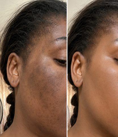 Routine Gold Anti-Taches – 24K + Extreme Light