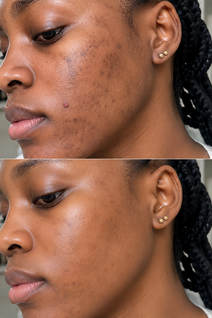 Routine Gold Anti-Taches – 24K + Extreme Light